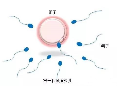 高龄二胎